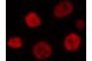 ABIN6274313 staining HT29 cells by IF/ICC. (MEF2B 抗体  (Internal Region))