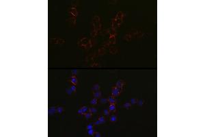 Immunofluorescence analysis of Jurkat cells using CCR5 Rabbit pAb (ABIN7266307) at dilution of 1:50 (40x lens). (CCR5 抗体  (AA 100-200))