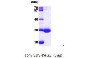 SDS-PAGE (SDS) image for RAP2A, Member of RAS Oncogene Family (RAP2A) (AA 1-180) protein (His tag) (ABIN7279276) (RAP2A Protein (AA 1-180) (His tag))