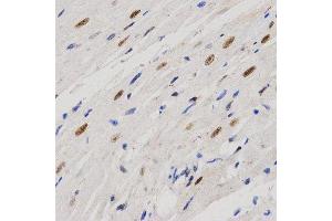Immunohistochemistry (IHC) image for anti-Proline-, Glutamic Acid- and Leucine-Rich Protein 1 (PELP1) (AA 1021-1180) antibody (ABIN3023502)