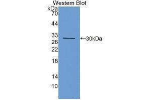 Western blot analysis of the recombinant protein. (Kallikrein 13 抗体  (AA 25-261))