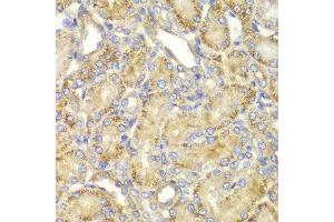 Immunohistochemistry of paraffin-embedded rat kidney using PPP2R2A antibody at dilution of 1:100 (400x lens). (PPP2R2A 抗体)