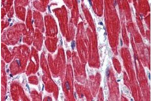 Human Heart: Formalin-Fixed, Paraffin-Embedded (FFPE) (STAU1/Staufen 抗体  (N-Term))