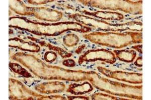 Immunohistochemistry of paraffin-embedded human kidney tissue using ABIN7171209 at dilution of 1:100 (SNCAIP 抗体  (AA 309-553))