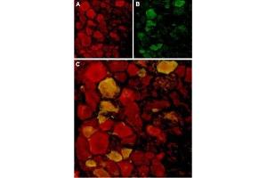 Immunohistochemistry (IHC) image for anti-Transient Receptor Potential Cation Channel, Subfamily V, Member 4 (TRPV4) (AA 853-871), (Intracellular) antibody (ABIN7043850)