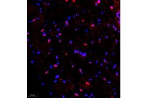 Immunofluorescence of paraffin embedded mouse heart using SMNDC1 (ABIN7075773) at dilution of 1:650 (400x lens) (SMNDC1 抗体)