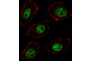Fluorescent image of U251 cell stained with ARGBP2 Antibody (N-term). (Sorbs2 抗体  (N-Term))