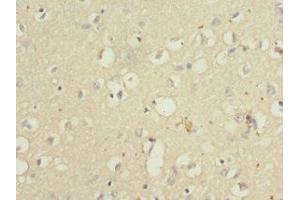 Immunohistochemistry of paraffin-embedded human brain tissue using ABIN7166001 at dilution of 1:100 (QKI 抗体  (AA 1-341))