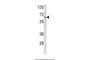 Western blot analysis of ENTH Antibody (Center) (ABIN390833 and ABIN2841059) in HL-60 cell line lysates (35 μg/lane). (CLINT1 抗体  (AA 222-249))