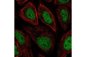 Immunofluorescent staining of SiHa cells with GTF2H3 polyclonal antibody  (Green) shows positivity in nucleus but excluded from the nucleoli. (GTF2H3 抗体)