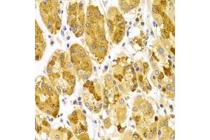 Immunohistochemistry (IHC) image for anti-Protein Kinase C, epsilon (PRKCE) (AA 488-737) antibody (ABIN3022942)