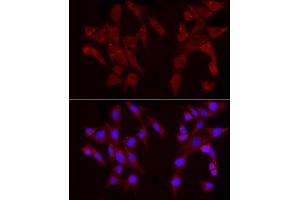 Immunofluorescence (IF) image for anti-Perilipin 2 (PLIN2) (AA 168-437) antibody (ABIN6145773)