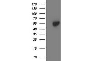 Western Blotting (WB) image for anti-Aminoacylase 1 (ACY1) antibody (ABIN1496452) (Aminoacylase 1 抗体)