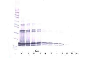 Image no. 1 for anti-Tumor Necrosis Factor (Ligand) Superfamily, Member 13b (TNFSF13B) antibody (ABIN465048) (BAFF 抗体)