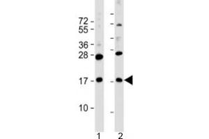 Western blot testing of human 1) MKN45 and 2) PANC-1 cell lysate with FAM159B antibody at 1:2000. (FAM159B 抗体  (AA 121-154))