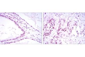 Immunohistochemical analysis of paraffin-embedded kidney convoluted tubule tissues (left) and esophageal cancer tissues (right) using SUZ12 mouse mAb with DAB staining. (SUZ12 抗体)