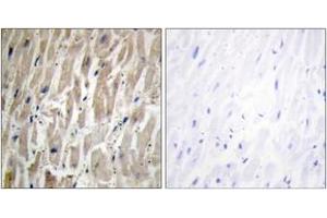 Immunohistochemistry (Paraffin-embedded Sections) (IHC (p)) image for anti-Cytochrome P450, Family 2, Subfamily J, Polypeptide 2 (CYP2J2) (AA 231-280) antibody (ABIN1534389)