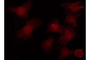 Immunofluorescence (fixed cells) (IF/ICC) image for anti-POU Domain, Class 2, Transcription Factor 1 (POU2F1) (Internal Region) antibody (ABIN6264361)