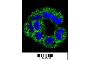 Confocal immunofluorescent analysis of ANXA2 Antibody with A2058 cell followed by Alexa Fluor 488-conjugated goat anti-rabbit lgG (green). (Annexin A2 抗体  (C-Term))