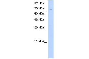 WB Suggested Anti-ZNF214 Antibody Titration:  0. (ZNF214 抗体  (C-Term))