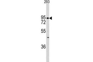 Western Blotting (WB) image for anti-K-Cadherin (CDH6) antibody (ABIN2997777) (CDH6 抗体)