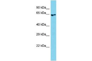 Western Blotting (WB) image for anti-rho Guanine Nucleotide Exchange Factor (GEF) 4 (ARHGEF4) (N-Term) antibody (ABIN2787993)