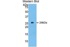 Western blot analysis of the recombinant protein. (LAP 抗体  (AA 320-519))