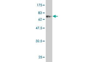 Western Blot detection against Immunogen (73. (CLN3 抗体  (AA 1-438))
