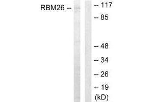 Western blot analysis of extracts from Jurkat cells, using RBM26 antibody. (RBM26 抗体  (C-Term))