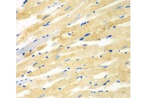 Immunohistochemistry of paraffin-embedded Rat heart using PDE4DIP Polyclonal Antibody at dilution of 1:100 (40x lens). (PDE4DIP 抗体)