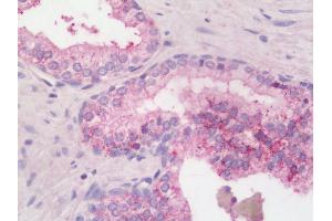 Human Prostate: Formalin-Fixed, Paraffin-Embedded (FFPE)