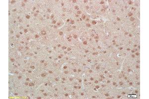Formalin-fixed and paraffin embedded rat brain labeled with Anti-Phospho-MEF2A (Ser408)Polyclonal Antibody, Unconjugated  at 1:200, followed by conjugation to the secondary antibody and DAB staining