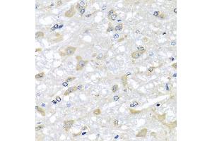 Immunohistochemistry of paraffin-embedded rat brain using RPLP1 antibody (ABIN5974064) at dilution of 1/100 (40x lens). (RPLP1 抗体)