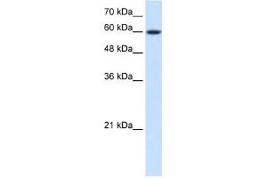 Western Blotting (WB) image for anti-Nuclear Receptor Subfamily 4, Group A, Member 3 (NR4A3) (Middle Region) antibody (ABIN2782304)