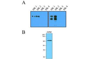 Western Blotting (WB) image for anti-Hexokinase 2 (HK2) (AA 1-917), (N-Term) antibody (ABIN263919) (Hexokinase 2 抗体  (N-Term))