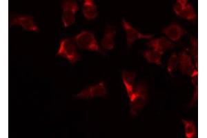 ABIN6266937 staining Hela by IF/ICC. (COX4I2 抗体  (Internal Region))