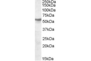 Image no. 1 for anti-Nicotinic Acetylcholine Receptor beta (CHRNB1) (Internal Region), (Subunit beta) antibody (ABIN374964) (CHRNB1 抗体  (Internal Region, Subunit beta))