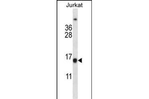 Western Blotting (WB) image for anti-B-Cell CLL/lymphoma 2 (BCL2) (AA 86-114) antibody (ABIN657744)