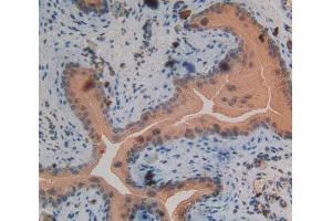 Used in DAB staining on fromalin fixed paraffin- embedded spermaduct tissue (PKC delta 抗体  (AA 328-674))