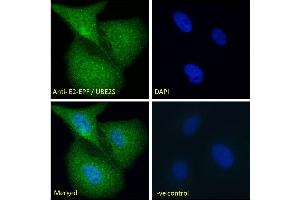 ABIN184893 Immunofluorescence analysis of paraformaldehyde fixed U2OS cells, permeabilized with 0. (UBE2S 抗体  (N-Term))