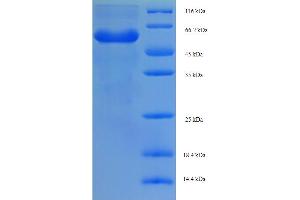 SDS-PAGE (SDS) image for RING1 and YY1 Binding Protein (RYBP) (AA 1-389), (partial) protein (His-SUMO Tag) (ABIN5710852)
