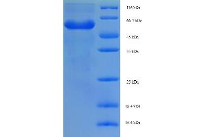 SDS-PAGE (SDS) image for RING1 and YY1 Binding Protein (RYBP) (AA 1-389), (partial) protein (His-SUMO Tag) (ABIN4977087) (RYBP Protein (AA 1-389, partial) (His-SUMO Tag))