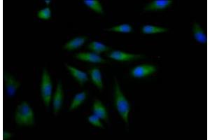 Immunofluorescence staining of Hela Cells with ABIN7127323 at 1:50, counter-stained with DAPI. (Recombinant ADAM17 抗体)
