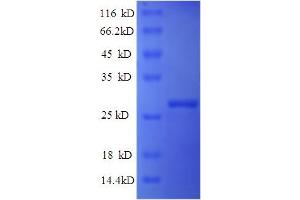 SDS-PAGE (SDS) image for Interferon, alpha-Inducible Protein 6 (IFI6) (AA 24-130) protein (His tag) (ABIN5713526) (IFI6 Protein (AA 24-130) (His tag))