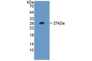 Figure. (RPL23A 抗体  (AA 2-156))