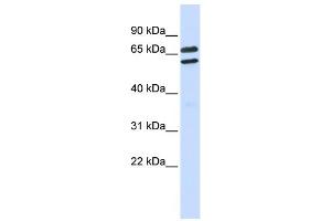 WB Suggested Anti-TRIML1 Antibody Titration:  0. (TRIML1 抗体  (Middle Region))