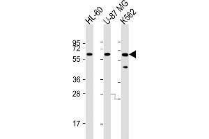 All lanes : Anti-IL1RL2 Antibody (Center) at 1:8000 dilution Lane 1: HL-60 whole cell lysate Lane 2: U-87 MG whole cell lysate Lane 3: K562 whole cell lysate Lysates/proteins at 20 μg per lane. (IL1RL2 抗体  (AA 257-286))