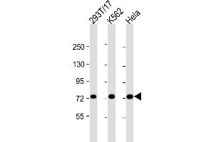 All lanes : Anti-MYBL2 Antibody (C-Term) at 1:2000 dilution Lane 1: 293T/17 whole cell lysate Lane 2: K562 whole cell lysate Lane 3: Hela whole cell lysate Lysates/proteins at 20 μg per lane. (MYBL2 抗体  (AA 540-571))