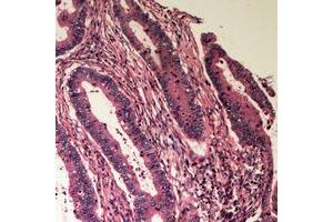 Immunohistochemistry (IHC) image for anti-UDP-Gal:betaGlcNAc beta 1,4- Galactosyltransferase, Polypeptide 2 (B4GALT2) (C-Term) antibody (ABIN7300398)