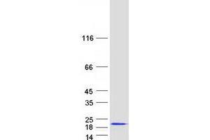 Western Blotting (WB) image for Small Ubiquitin Related Modifier 3 (SUMO3) protein (Myc-DYKDDDDK Tag) (ABIN2732983)